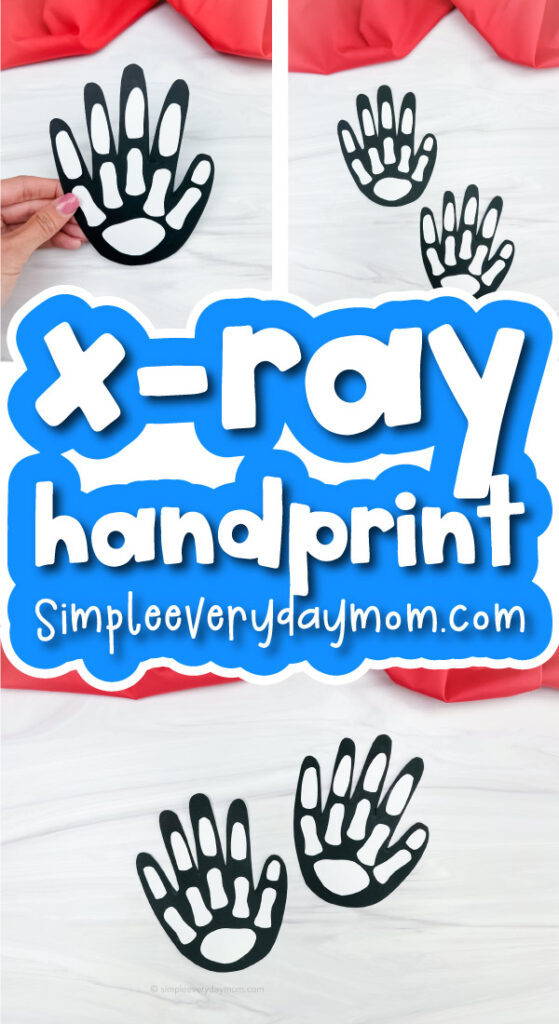 x ray handprint craft image collage with the words x-ray handprint